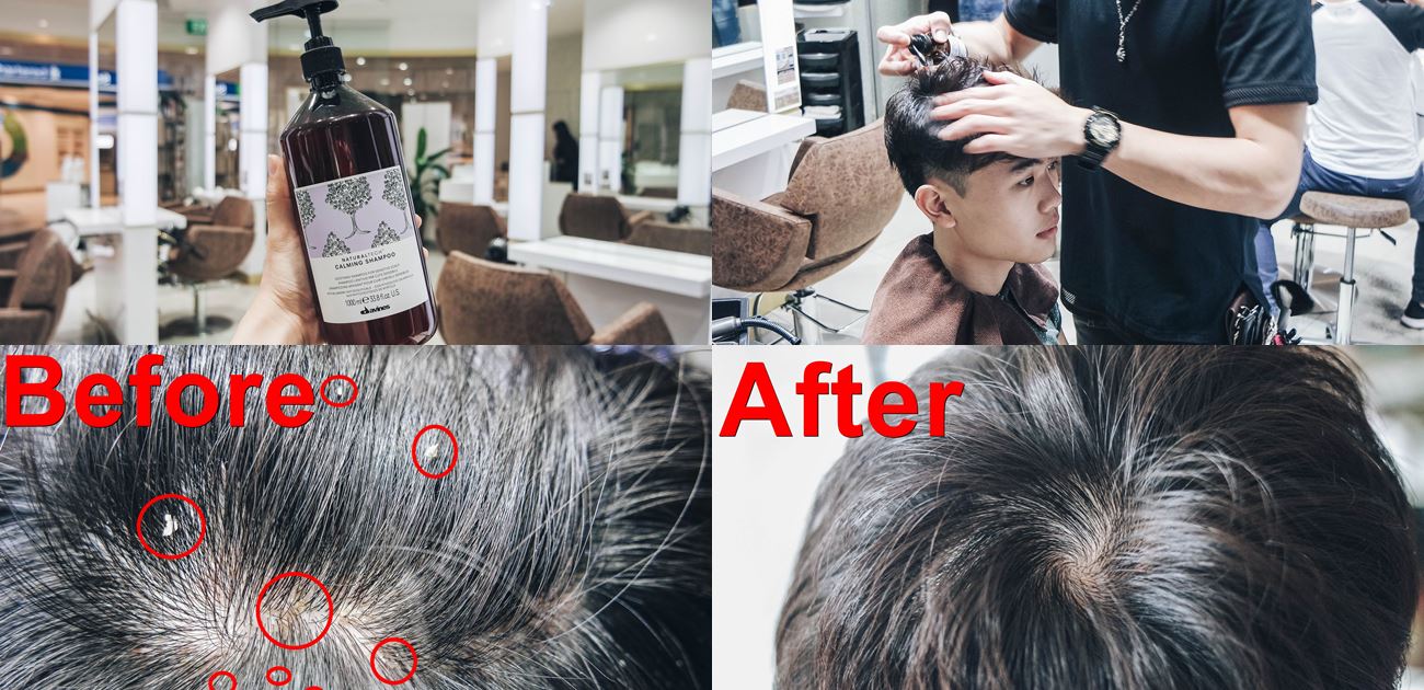 Kenjo Salon Scalp Treatment